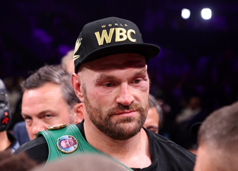 Tyson Fury shows off battered and bloodied face after controversial Francis Ngannou win… as MMA hero looks untouched