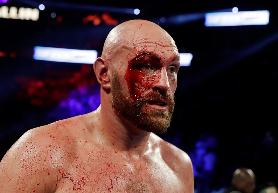 Tyson Fury’s hero cut man – who saved career in Wallin fight – was sent money by Gypsy King during Covid pandemic