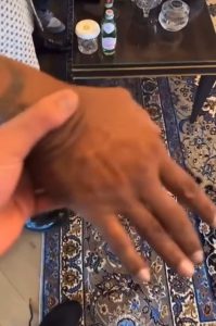 Amir Khan leaves fans baffled with ‘weirdest thing ever’ video of Mike Tyson’s hands after Tyson Fury vs Francis Ngannou