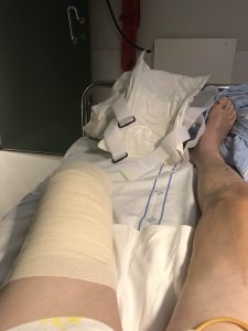 Iconic tennis coach who guided Roger Federer to his first Wimbledon title has foot AMPUTATED after freak injury