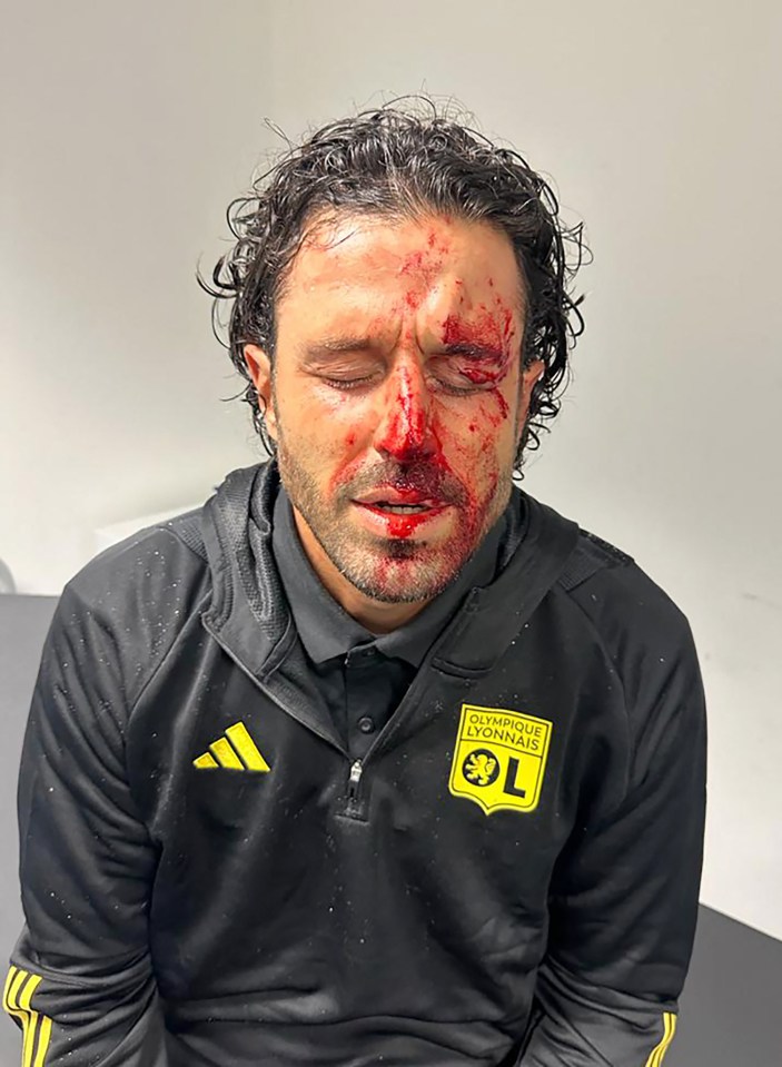 Fabio Grosso shows off horror injuries from bus attack with Lyon boss left needing 13 stitches after shocking scenes