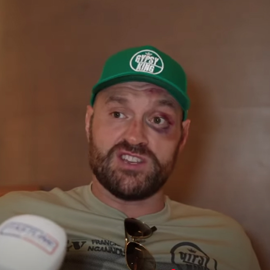 Tyson Fury risks being forced into Oleksandr Usyk fight on December 23 despite battered face after Francis Ngannou fight