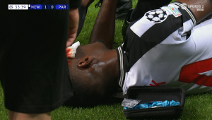 Newcastle star Alexander Isak left covered in blood and has to have head bandaged up as fans compare him to club legend