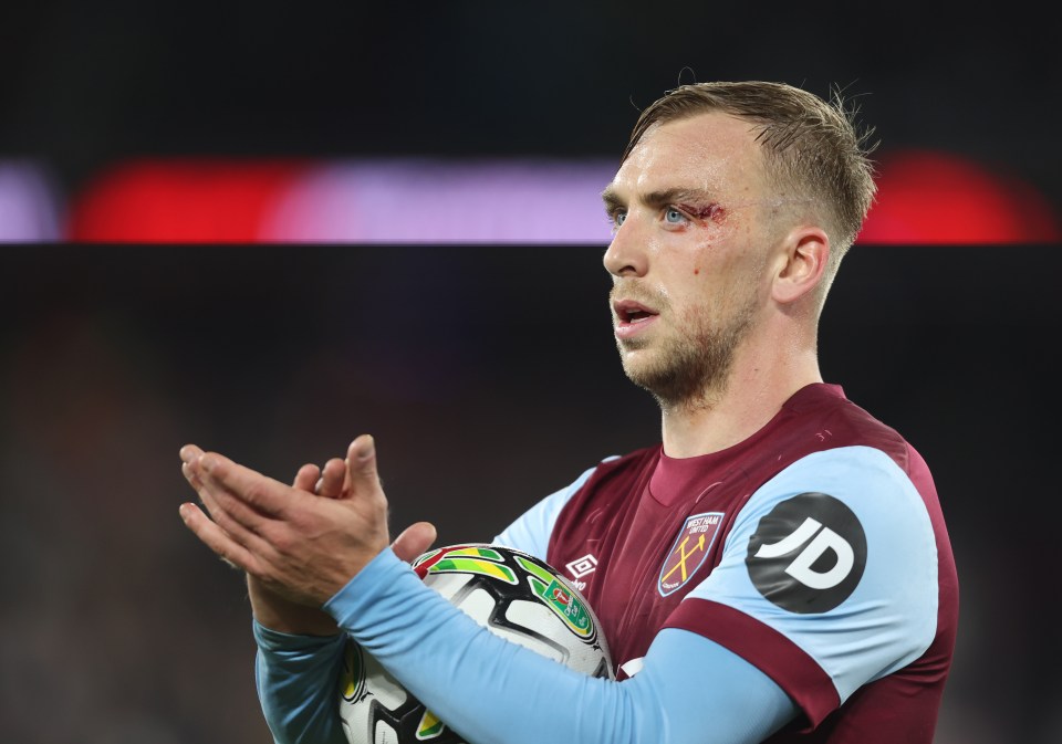 Jarrod Bowen shows off nasty cut with eye left bleeding after West Ham’s thumping Carabao Cup win over Arsenal