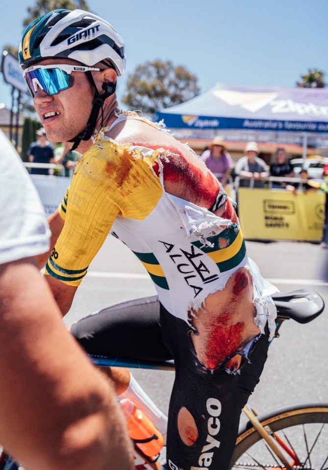 Cyclist left covered in blood with ‘lots of skin missing’ as he suffers nasty injuries after crash in Tour Down Under