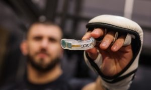 Smart mouthguards: What are the ‘game-changing’ gum shields and how are they being used in the Six Nations 2024 