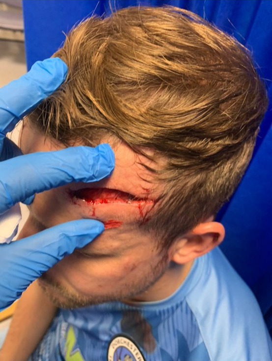 Non-league star shows off gruesome cut after being kicked in the head as sickened fans say rival ‘should be arrested’