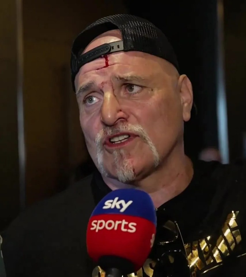 John Fury breaks silence on headbutting Usyk team member as Tyson’s bloodied dad says ‘I’m a warrior, that’s what we do’