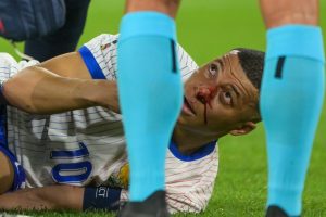 Why Kylian Mbappe will be BANNED from wearing his special face mask for France at Euro 2024 to protect broken nose