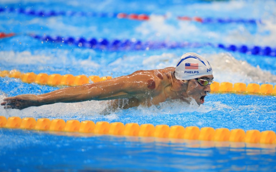 What is cupping: Why do swimmers have circles on their bodies at the Olympics?