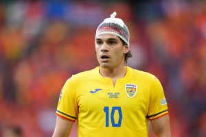 Fans compare Romania star to an ONION as he is forced to wear hair net after nasty head injury against Holland