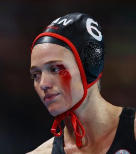 Olympics star left with gruesome injury and blood pouring from eye after brutal collision in water polo clash