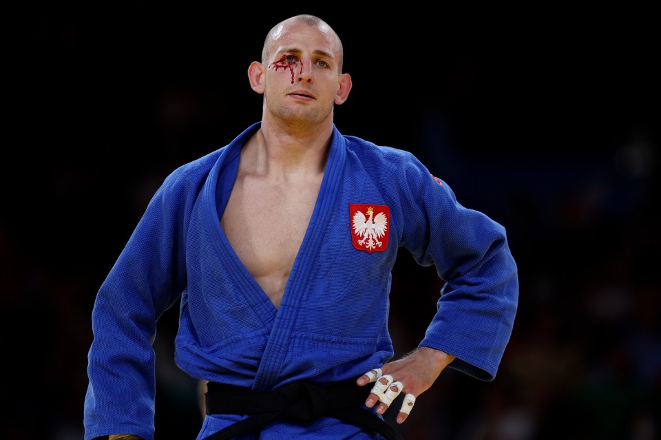 Olympics Judo star shows off horror injury as Paris 2024 dream ended in brutal fashion