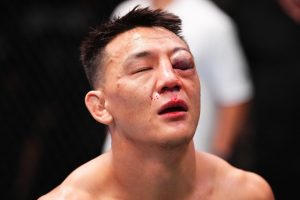 Fans fear UFC star ‘may have lost eye’ after being rushed to hospital with horror injury following brutal defeat