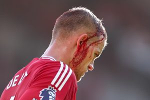 Major controversy as Man Utd concede after bloodied Matthijs de Ligt is told to LEAVE pitch for treatment vs Brentford