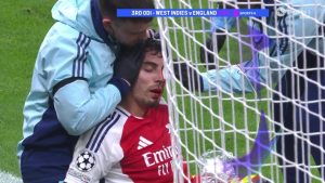 Kai Havertz left with blood pouring from his head after Arsenal star’s sickening clash of heads