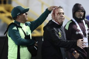 Honduras slapped with final punishment decision after Mexico coach hit by beer can and left with blood pouring down face