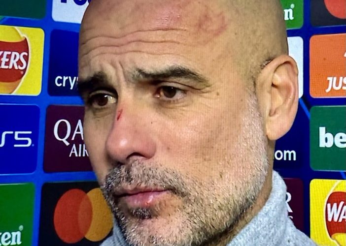 What Man City must urgently fix as it gets so bad for Pep Guardiola he is left with scratches all over head