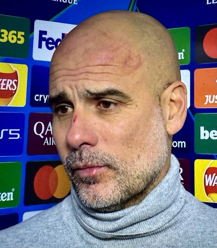 What Man City must urgently fix as it gets so bad for Pep Guardiola he is left with scratches all over head