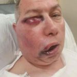 Cricket umpire left unrecognisable after horror facial injuries but says he ‘feels like he won lottery’