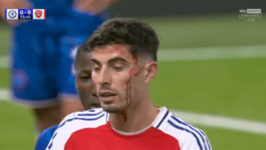 Kai Havertz left covered in blood as horror head wound opens back up with Arsenal star forced off pitch against Chelsea