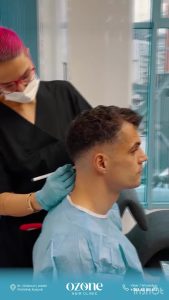 Granit Xhaka reveals reason for dramatic new look with ex-Arsenal star having undergone hair transplant